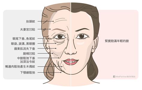 法令紋女面相|【法令紋圖解】法令紋圖解全解析！看懂你的運勢與命理